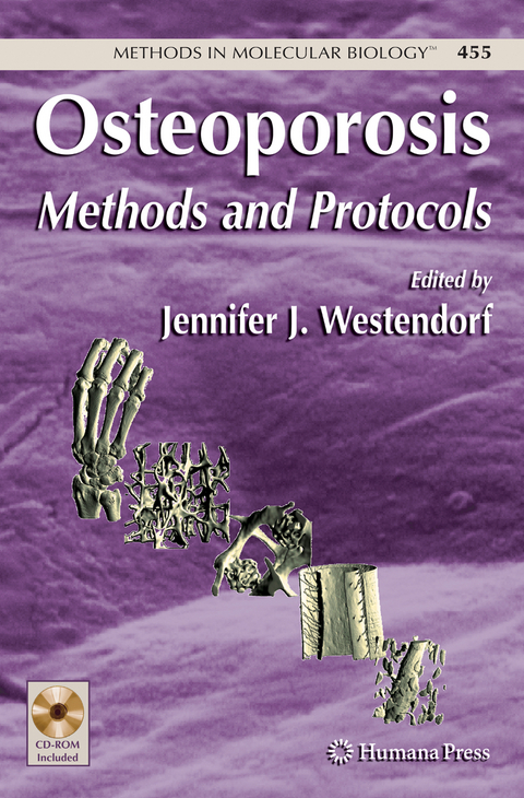 Osteoporosis - 