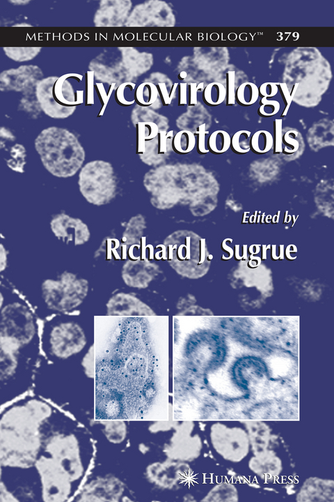 Glycovirology Protocols - 