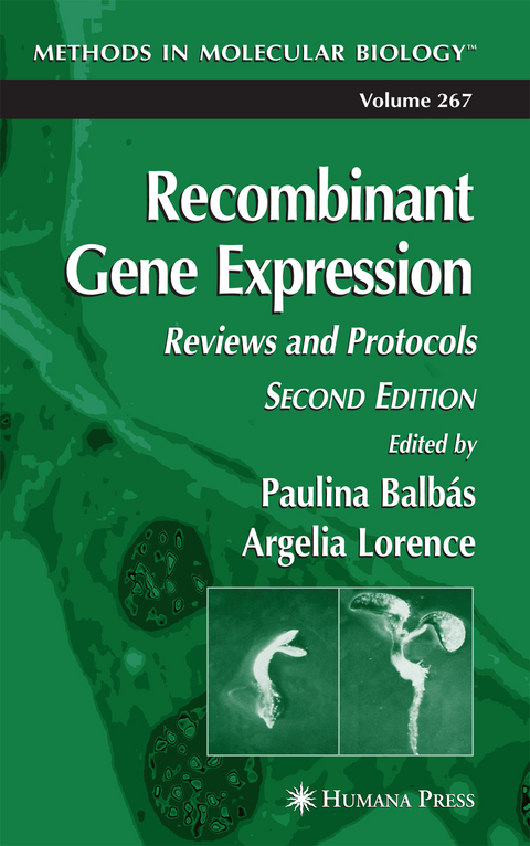 Recombinant Gene Expression - 