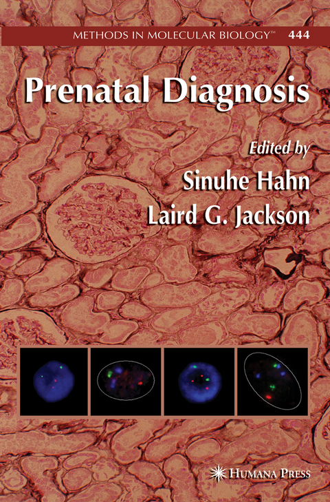 Prenatal Diagnosis - 