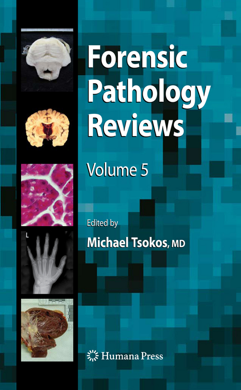 Forensic Pathology Reviews 5 - 