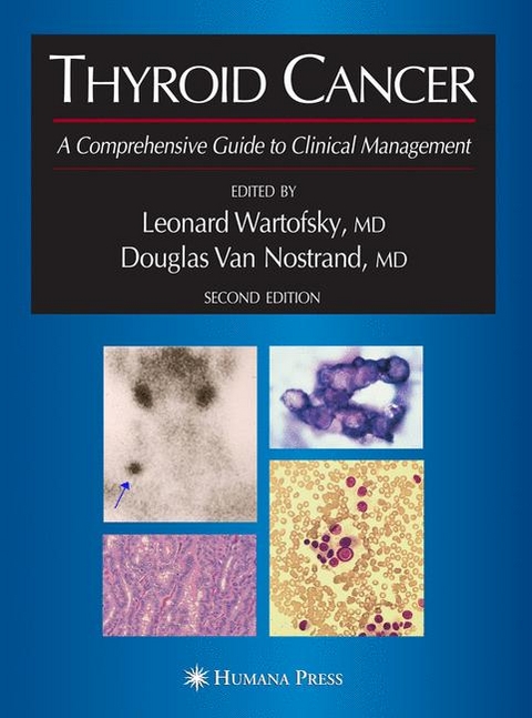 Thyroid Cancer - 