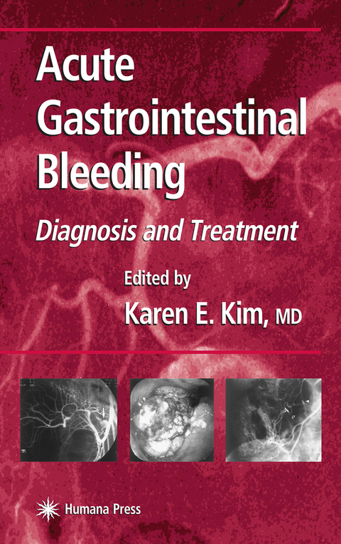 Acute Gastrointestinal Bleeding - 