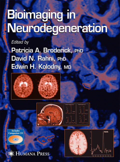 Bioimaging in Neurodegeneration - 