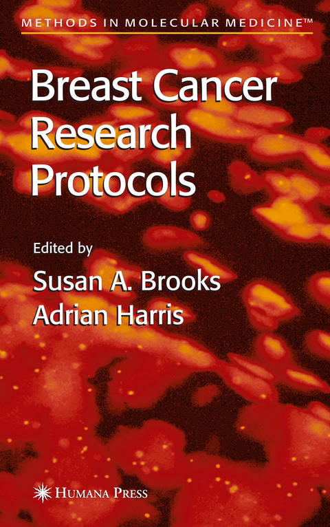 Breast Cancer Research Protocols - 