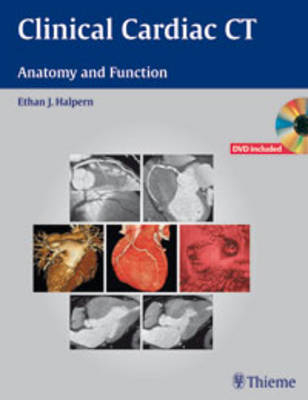 Clinical Cardiac CT - Ethan Halpern