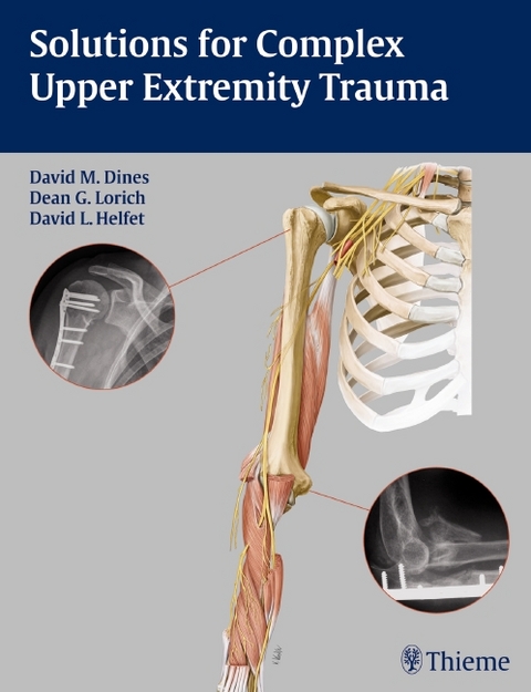 Solutions for Complex Upper Extremity Trauma - 