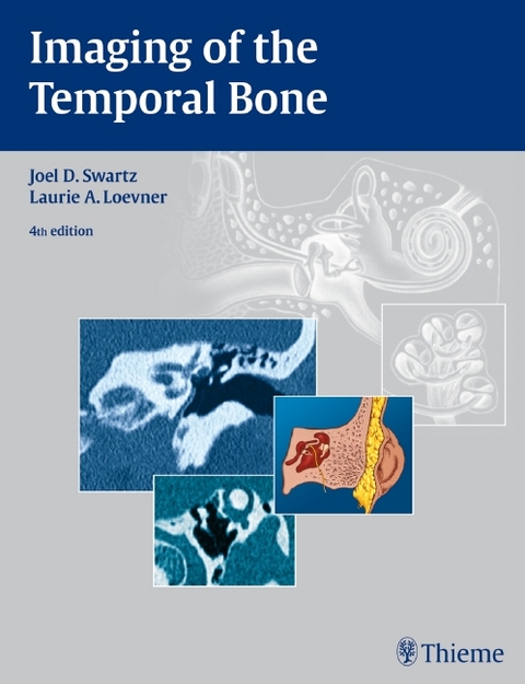 Imaging of the Temporal Bone - Joel D. Swartz, Laurie A. Loevner
