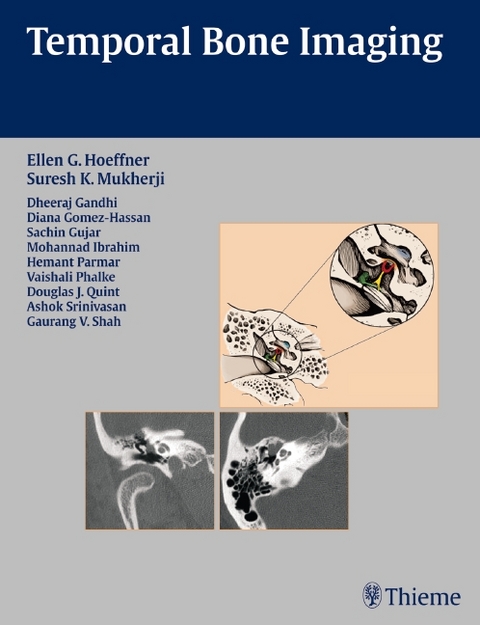 Temporal Bone Imaging - 