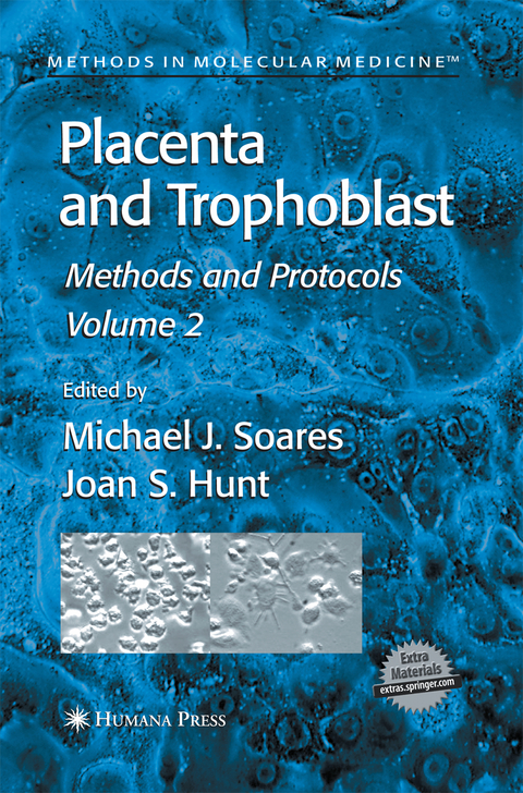 Placenta and Trophoblast - 