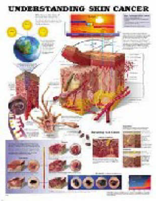 Understanding Skin Cancer -  Anatomical Chart Company