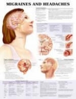 Migraines and Headaches Anatomical Chart - 