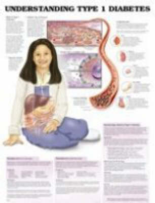 Understanding Type 1 Diabetes Chart