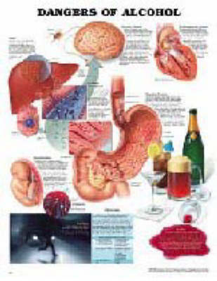 Dangers of Alcohol Anatomical Chart - 