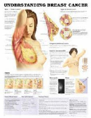 Understanding Breast Cancer -  Anatomical Chart Company