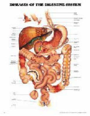 Diseases of the Digestive System -  Anatomical Chart Company