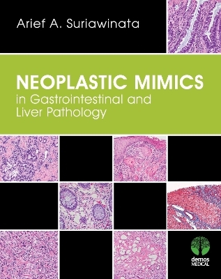 Neoplastic Mimics in Gastrointestinal and Liver Pathology - Arief A. Suriawinata