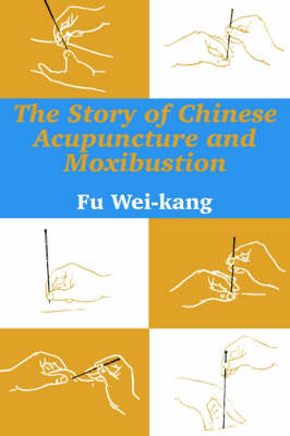 The Story of Chinese Acupuncture and Moxibustion - Fu Wei-kang