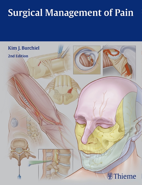 Surgical Management of Pain - 