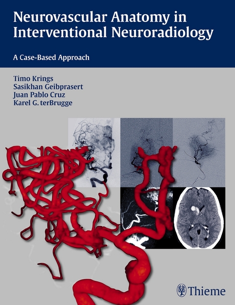 Neurovascular Anatomy in Interventional Neuroradiology - Timo Krings, Sasikhan Geibprasert, Juan Pablo Cruz, Karel ter Brugge
