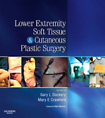 Lower Extremity Soft Tissue & Cutaneous Plastic Surgery E-Book -  Mary Elizabeth Crawford,  G Dock Dockery