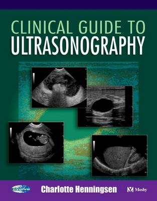Clinical Guide to Ultrasonogaphy Electronic Image Collection - Charlotte Henningsen