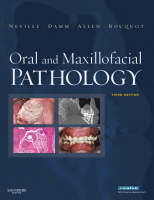 Oral and Maxillofacial Pathology - Brad W. Neville, Douglas D. Damm, Jerry E. Bouquot, Carl M. Allen