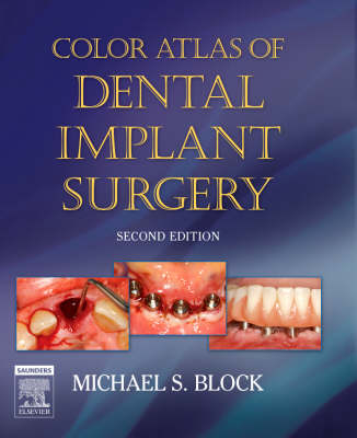 Color Atlas of Dental Implant Surgery - Michael S. Block