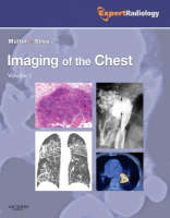 Imaging of the Chest, 2-Volume Set - Nestor L. Muller, C. Isabela S. Silva