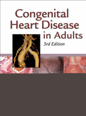 Congenital Heart Disease in Adults - Joseph K. Perloff, John S. Child, Jamil Aboulhosn