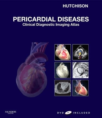 Pericardial Diseases - Stuart J. Hutchison