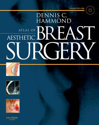 Atlas of Aesthetic Breast Surgery - Dennis C. Hammond