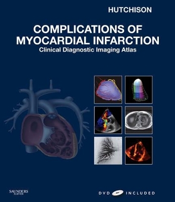 Complications of Myocardial Infarction - Stuart J. Hutchison