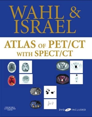 Atlas of PET/CT with SPECT / CT - Richard L. Wahl, Ora Israel