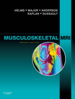 Musculoskeletal MRI - Clyde A. Helms, Nancy M. Major, Mark W. Anderson, Phoebe Kaplan, Robert Dussault