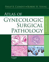 Atlas of Gynecologic Surgical Pathology - Philip B. Clement, Robert H. Young