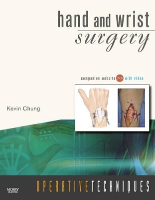 Hand and Wrist Surgery - Kevin C. Chung