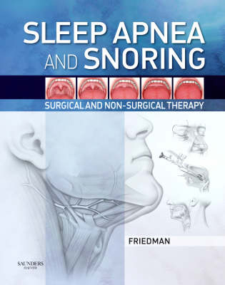 Sleep Apnea and Snoring - 