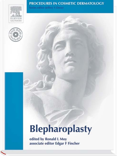 Blepharoplasty - 