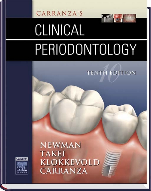 Carranza's Clinical Periodontology - Michael G. Newman, Henry Takei, Perry R. Klokkevold, Fermin A. Carranza
