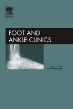 Post Traumatic Reconstruction of the Foot and Ankle - Alastair S. E. Younger