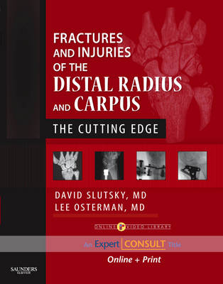 Fractures and Injuries of the Distal Radius and Carpus - David J. Slutsky, A. Lee Osterman