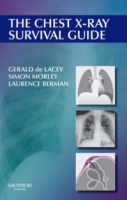 The Chest X-ray Survival Guide - Gerald De Lacey, Laurence Berman, Simon Morley