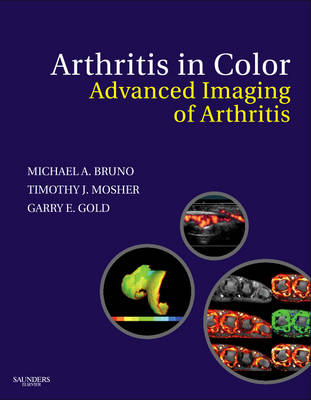 Arthritis in Color - Michael A. Bruno, Gary E. Gold, Timothy J. Mosher