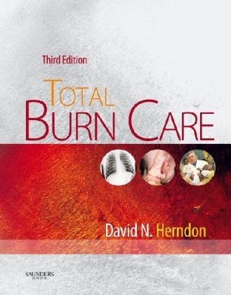 Total Burn Care - David N. Herndon