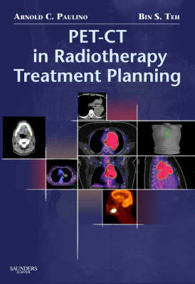 PET-CT in Radiotherapy Treatment Planning - Arnold C. Paulino