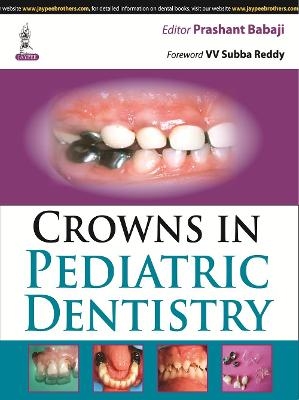 Crowns in Pediatric Dentistry - Prashant Babaji