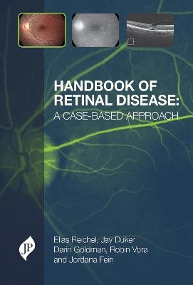 Handbook of Retinal Disease: a Case-based Approach - Elias Reichel, Jay Duker, Darin Goldman, Jordana Fein, Robin Vora