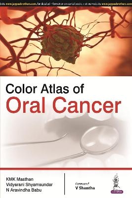 Color Atlas of Oral Cancer - Kmk Masthan, Vidyarani Shyamsundar, N Aravindha Babu