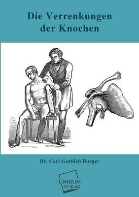 Die Verrenkungen der Knochen - Carl Gottlieb Burger